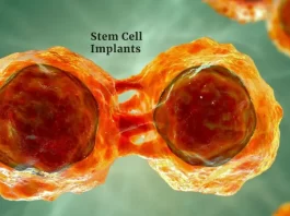 Stem Cell Implant, located in California, secures an undisclosed sum in seed funding. The supporters were kept a secret. The company intends to use the money to use stem cell biotechnology to advance dentistry.