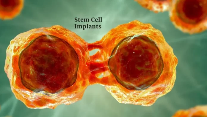 Stem Cell Implant, located in California, secures an undisclosed sum in seed funding. The supporters were kept a secret. The company intends to use the money to use stem cell biotechnology to advance dentistry.